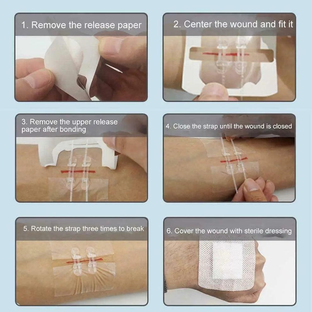 Bandes Adhésives à Fermeture Éclair – Soin des Plaies Sans Suture (2 Pièces)